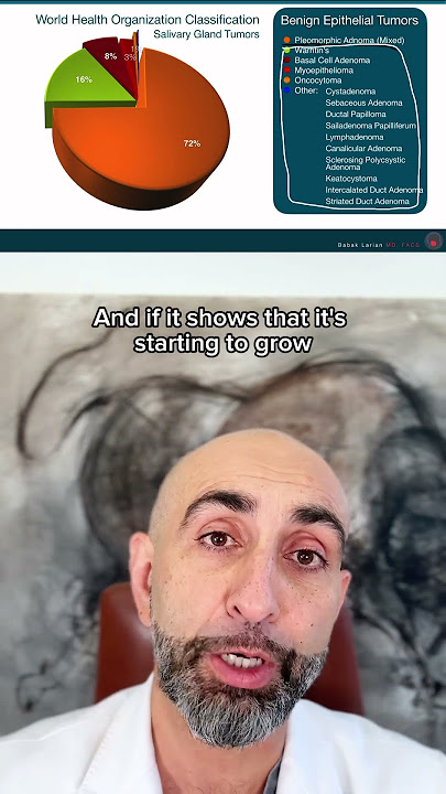 Do all parotid tumors need to be treated with surgery?