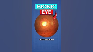 Wetenschappers creëren ECHT bionisch oog