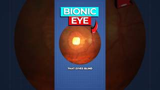 Famous Scientists Create REAL Bionic Eye Wealth