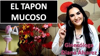 TAPON MUCOSO, POR GINECOLOGA DIANA ALVAREZ