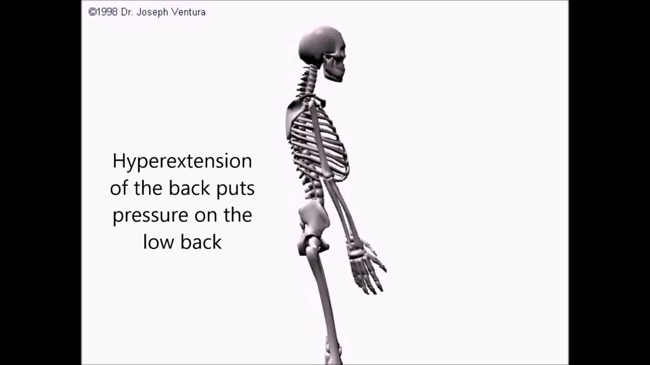 The Most Common Causes Of Low Back Pain - YouTube