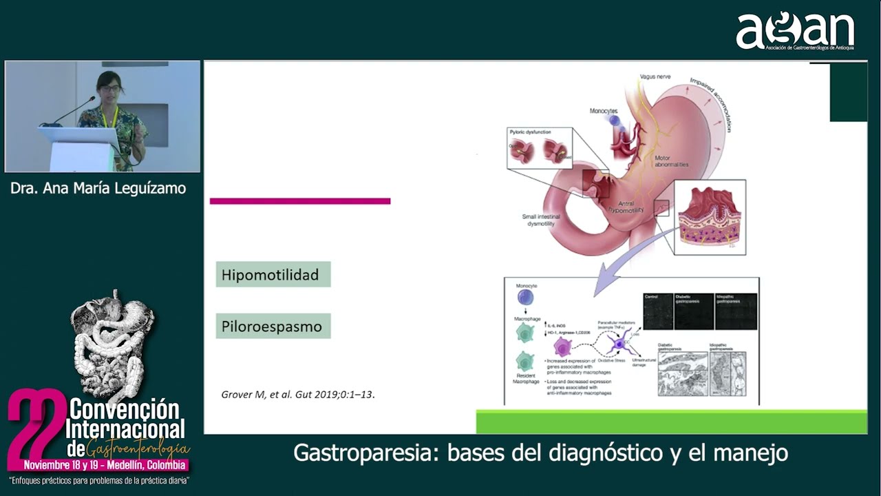 Gastroparesia, bases del diagnóstico y el manejo - Dra. Ana María Leguízamo
