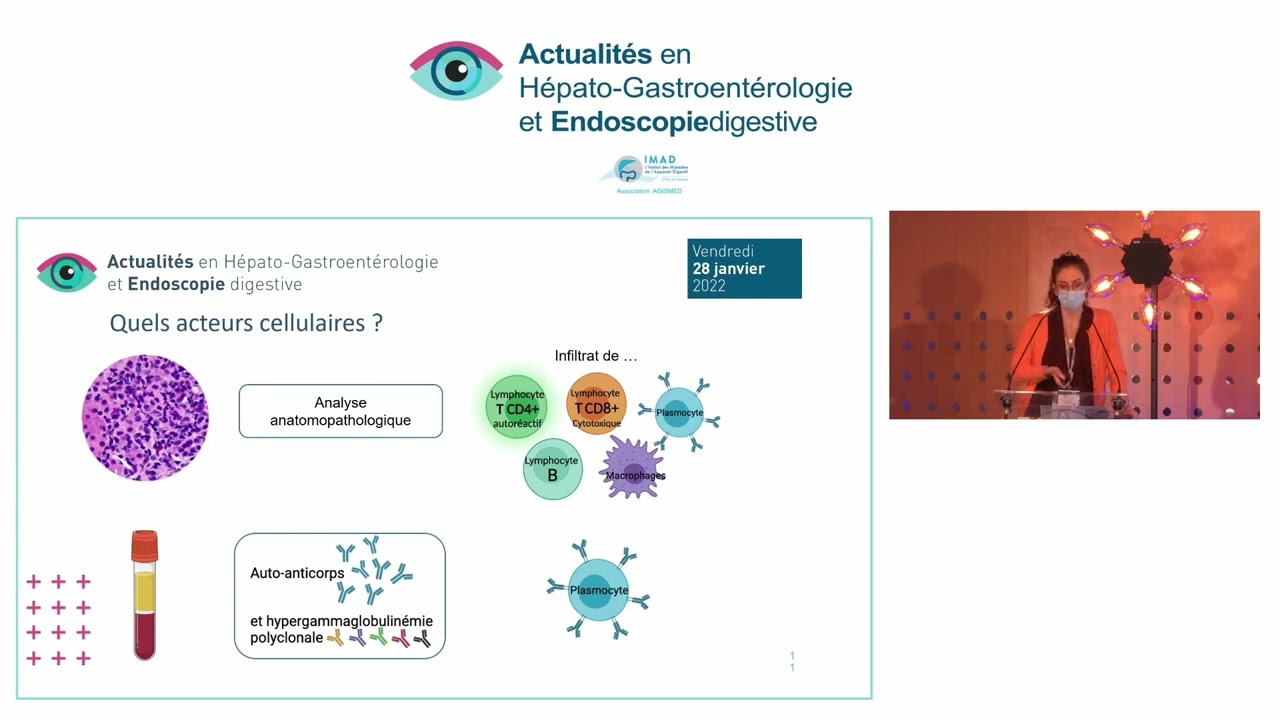 Mécanisme des hépatites auto immunes