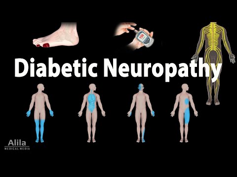 Videó: Diabetikus neuropátia kutyákban