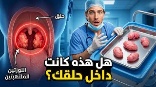 شاهد كيفية إزالة اللوزتين جراحياً | Tonsil Removal Surgery Explained Like Never Before 3D