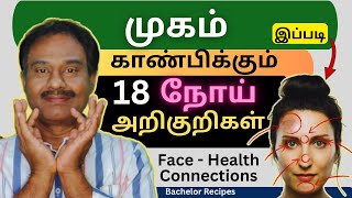 வட்டமான நிலா முகம் ஆரோக்கியமானதல்ல / Face - Health Connections / Face Signs & Symptoms