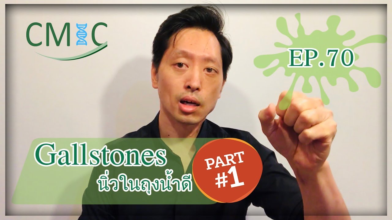 นิ่วในถุงน้ำดี: Part 1 (Gallstones) โดยนายแพทย์จักรีวัชร
