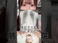 【入院】肺炎でしにかけてました・・・