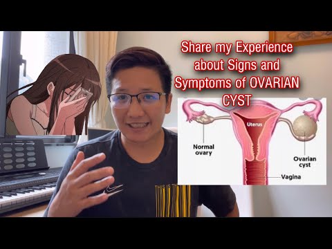 Video: Paano Mag-alis ng isang Ovarian Cyst: 10 Hakbang (na may Mga Larawan)