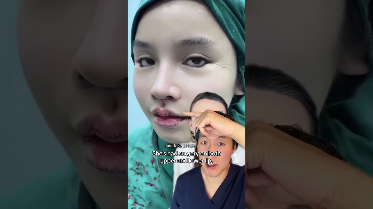 Plastic Surgery How Much Is Too Plasticsurgery