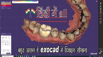 zirconia crown design exocad HINDI & exocad bridge design| exocad smile design🦷😁