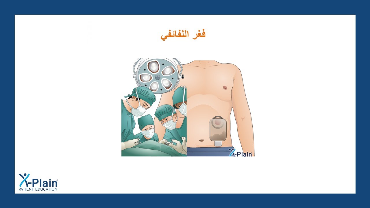 فغر اللفائفي