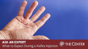 What to Expect During and After Dupuytren