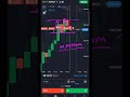 How To Trade By M Pattern In Consolidation Area#binaryoptions