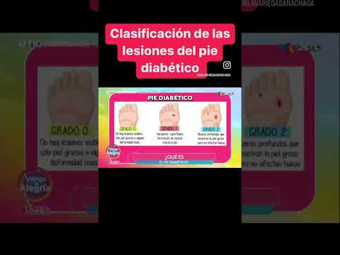 Clasificación de las