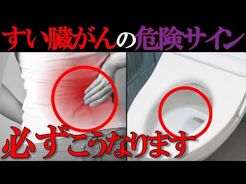 【医師監修】放置厳禁！知らないと後悔する「すい臓がんの初期症状」