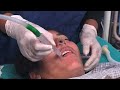 Suctioning the Airway - Emergency Care Series
