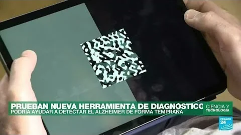 ¿En qué consiste el test de 30 preguntas para detectar la demencia?