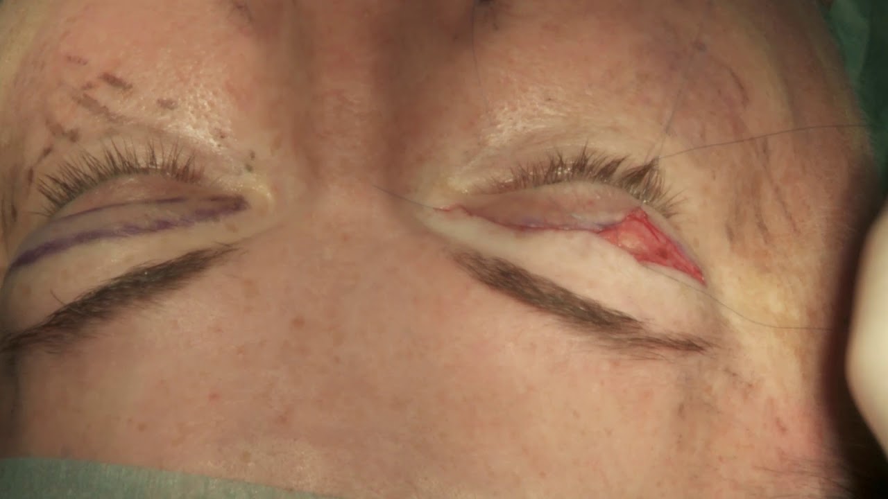 clinicas adelgazamiento marbella