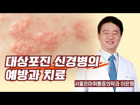 대상포진 신경병의 예방과 치료 / 서울은마취통증의학과 이은형