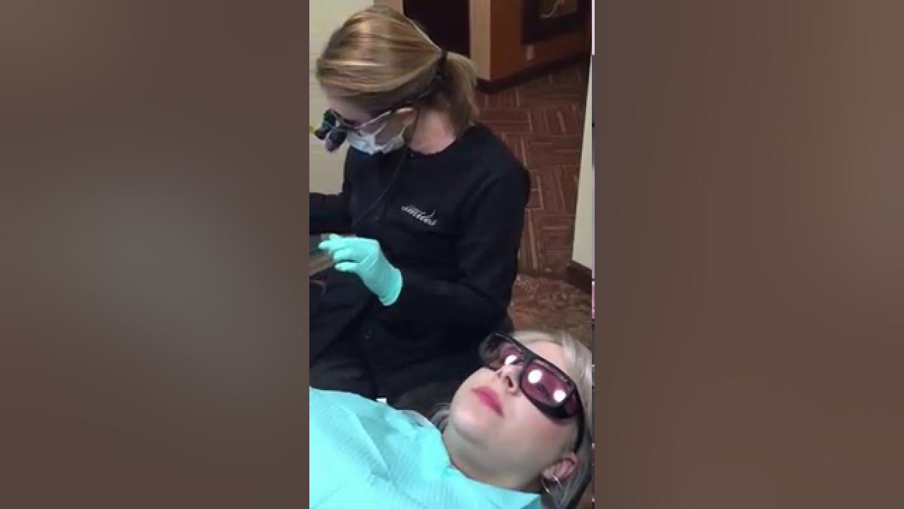 Laser revision of lip tie YouTube