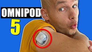 Omnipod 5 - Full Review - This is it!