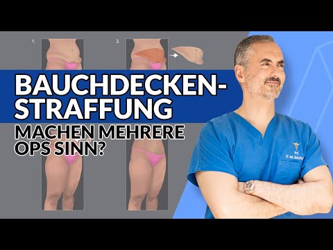 Your Plastic Surgery Coach – Dissatisfied with your tummy tuck?