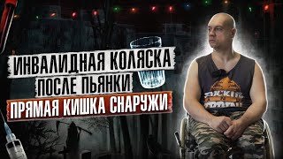 ИНВАЛИДНАЯ КОЛЯСКА ПОСЛЕ ПЬЯНКИ | ПРЯМАЯ КИШКА СНАРУЖИ | ЖИВОЙ ПОСЛЕ СМЕРТИ | ИНВАЛИД-АЛКОГОЛИК