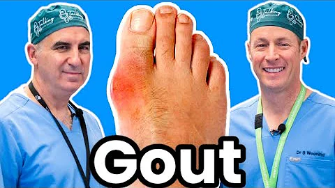 Do You Have Gout?  Here's How To Diagnose, Treat and Prevent It