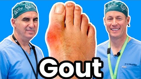 Do You Have Gout?  Here