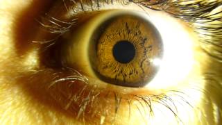 , Pupila Dilatandose Slow, Partes Del Cuerpo