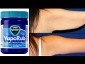 ADIÓS A LOS BRAZOS GORDITOS Y FLACIDOS EN 2 PASOS | CON VICK VAPORUB