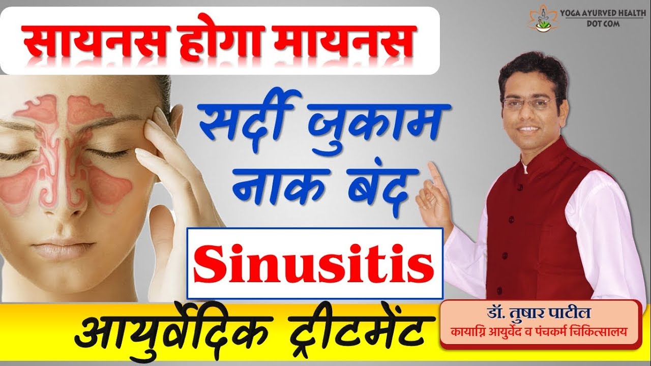 sinusitis ka ilaj sinusitis treatment सायनस की ट्रीटमेंट 