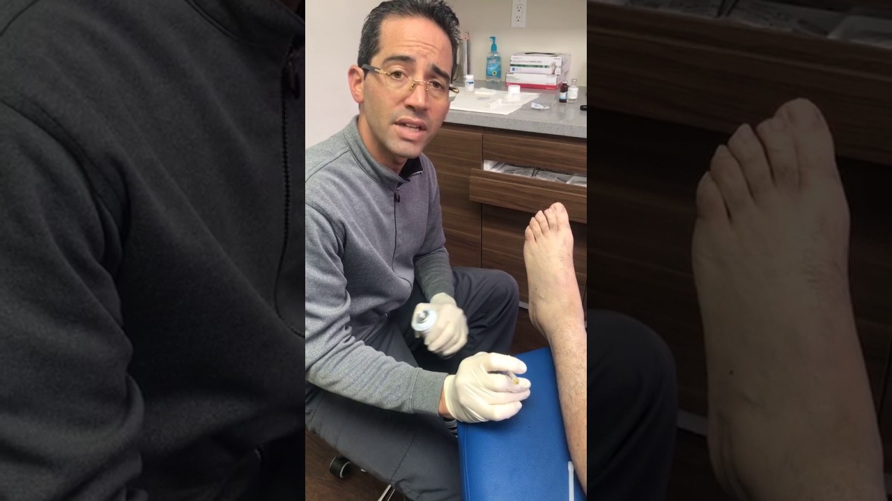 sinus tarsi injection YouTube