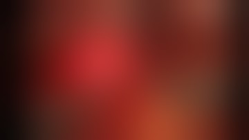 Zero-ischemia laparoscopic partial right nephrectomy