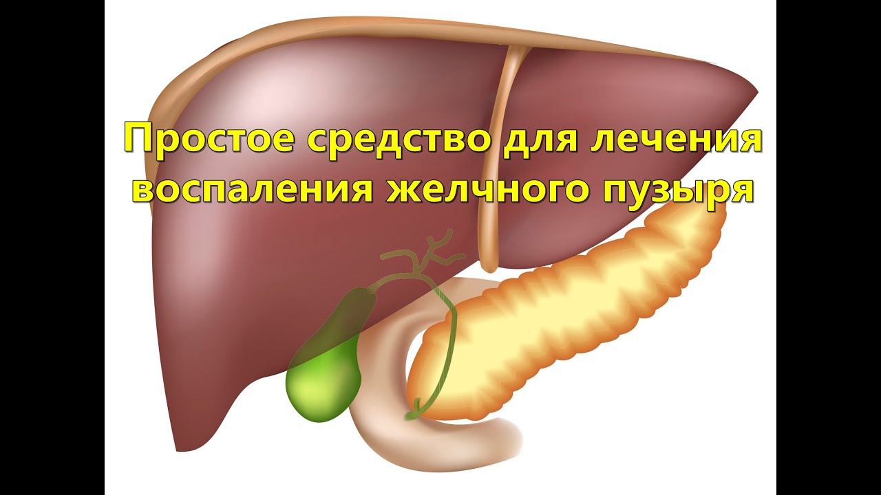 Простое средство для лечения воспаления желчного пузыря - YouTube