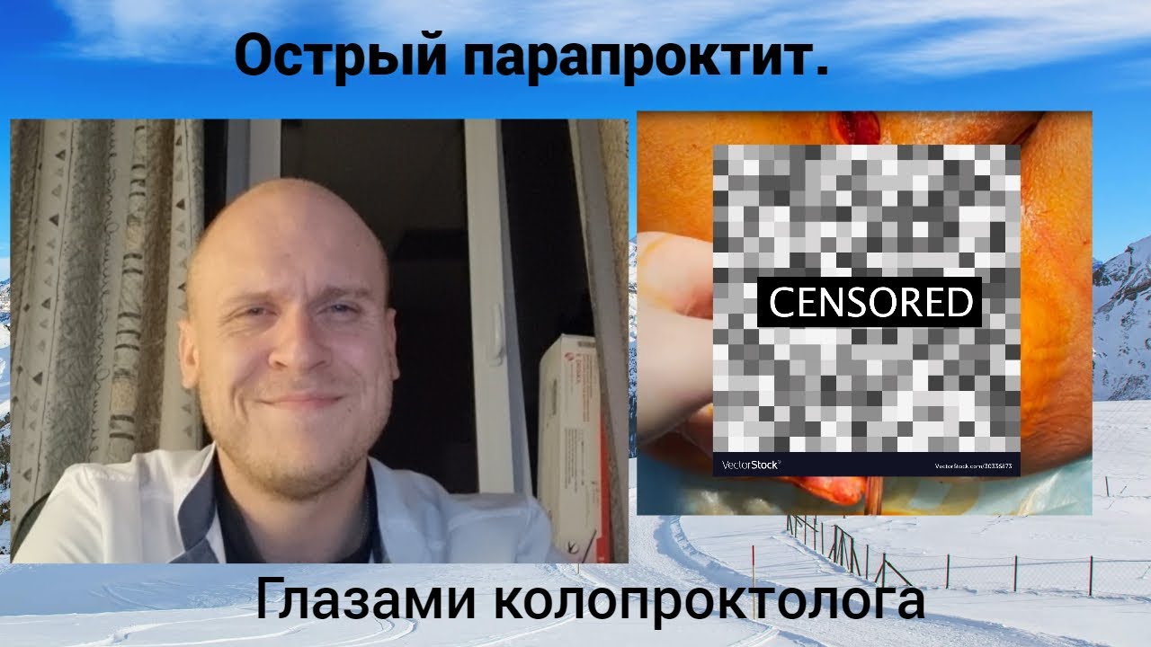 Острый парапроктит. Глазами колопроктолога. - YouTube