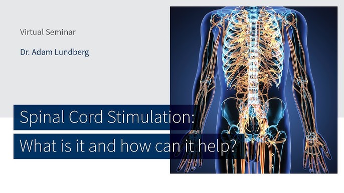 Spinal cord stimulation doesn't help with back pain, says new