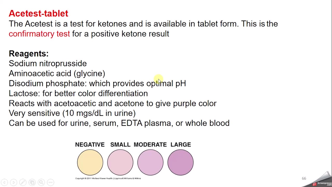 Urinalysis ketones and nitrite YouTube