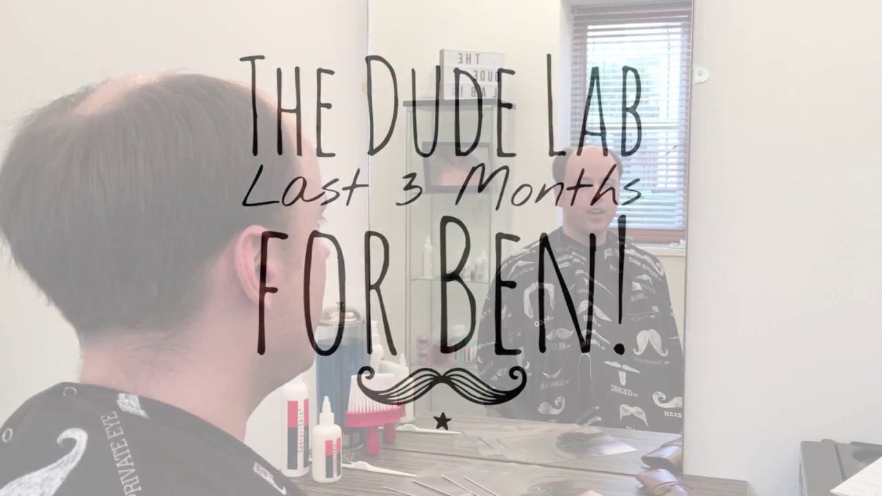 Total Cover Plus by The Dude Lab - Hair replacement system - last 3 months for Ben!