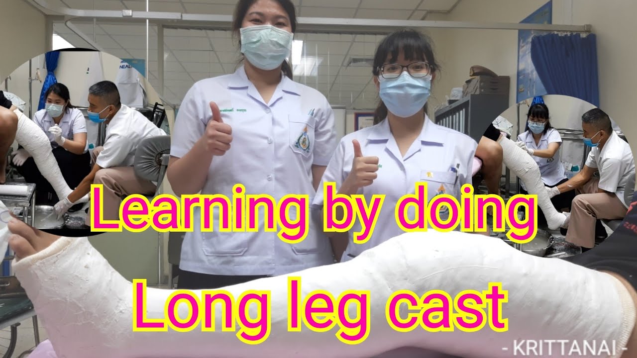 Learning by doing in The CastRoom#:Long leg cast case failed P/S Fx ...