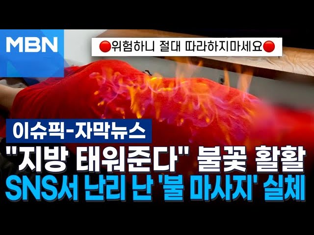 [자막뉴스] ＂지방 태워준다＂ 불꽃 활활…SNS서 난리 난 '불 마사지' 실체 | 이슈픽
