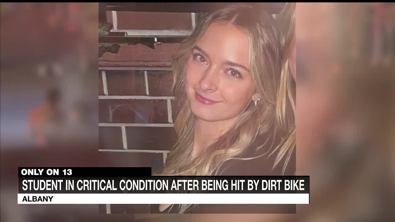 UAlbany freshman in critical condition after being hit by dirt bike