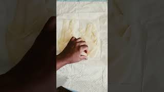 How to Apply Sterile Gloves | Applying Sterile Gloves nursing nursingshorts