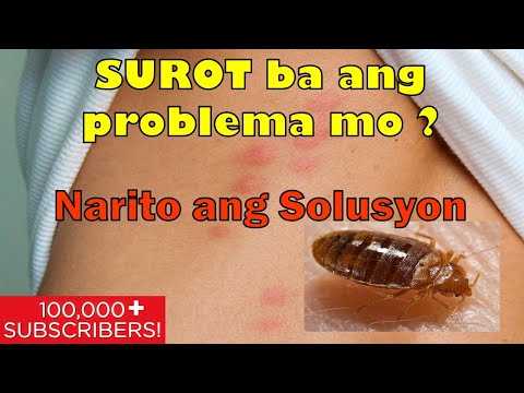 Video: Paano Mapupuksa ang Fleas gamit ang Sabon sa Paghuhugas ng pinggan: 11 Mga Hakbang