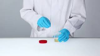 Nal von minden - LabTeamet - NADAL® Microalbumin Test urine   Microalbumin rapid test