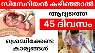 സിസേറിയൻ കഴിഞ്ഞാൽ ആദ്യത്തെ 45 ദിവസം ഇതൊക്കെ ശ്രെദ്ധിക്കുക/How to care after cesarean | delivery care