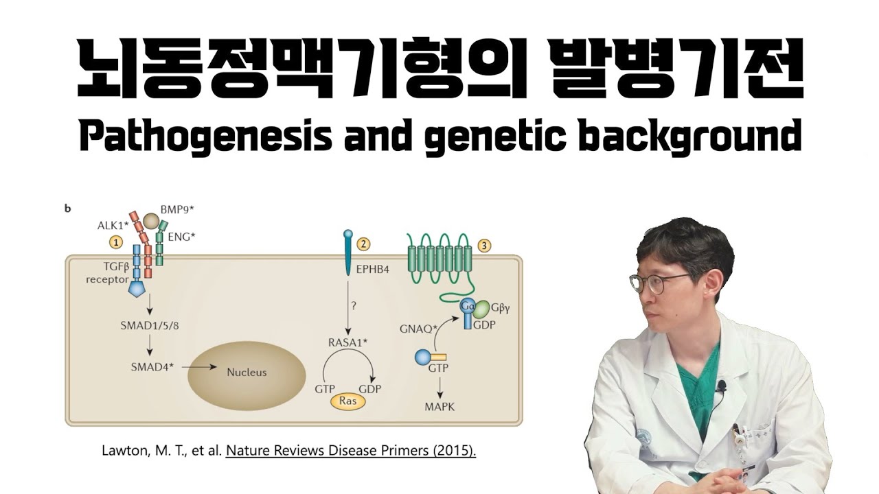 [뇌동정맥기형 전문가용] 뇌동정맥기형의 발병 기전 Pathogenesis of brain AVM
