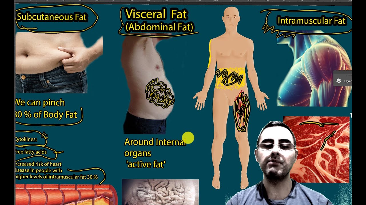 Intramuscular Fat vs. Other Body Fats: Key Differences; How to Reduce