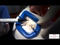 Simply Teeth - Carrying out a Philips ZOOM!® whitening system